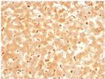 Alpha-2-Macroglobulin Antibody in Immunohistochemistry (Paraffin) (IHC (P))