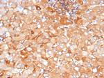 Alpha-2-Macroglobulin Antibody in Immunohistochemistry (Paraffin) (IHC (P))