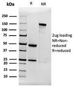Alpha-2-Macroglobulin Antibody in SDS-PAGE (SDS-PAGE)