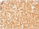 Alpha-2-Macroglobulin Antibody in Immunohistochemistry (Paraffin) (IHC (P))