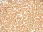 Alpha-2-Macroglobulin Antibody in Immunohistochemistry (Paraffin) (IHC (P))