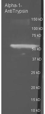 alpha-1-Anti-Trypsin Antibody in Western Blot (WB)