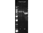 Plasminogen Antibody in Western Blot (WB)