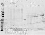 Aldolase Antibody in Immunoprecipitation (IP)