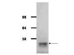 Aldolase Antibody in Western Blot (WB)