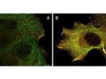 Phospho-AKT (Ser473) Antibody in Immunocytochemistry (ICC/IF)