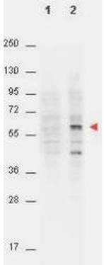 Phospho-AKT (Thr308) Antibody in Western Blot (WB)