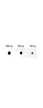 Insulin Antibody in Dot Blot (DB)