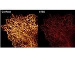 alpha-Tubulin Antibody in Immunocytochemistry (ICC/IF)