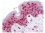 Stat2 Antibody in Immunohistochemistry (Paraffin) (IHC (P))