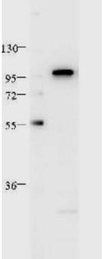 Stat2 Antibody in Western Blot (WB)