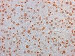 AKT3 Antibody in Immunohistochemistry (Paraffin) (IHC (P))