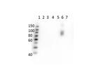 Hemoglobin beta S Antibody in Western Blot (WB)