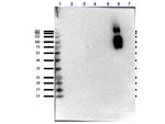 Hemoglobin beta S Antibody in Western Blot (WB)