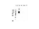 Hemoglobin beta A-2 Antibody in Western Blot (WB)