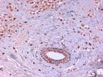 AKT2 Antibody in Immunohistochemistry (Paraffin) (IHC (P))