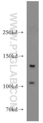 TGFBR3 Antibody in Western Blot (WB)