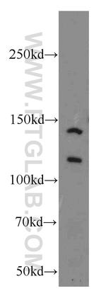 NCOR1 Antibody in Western Blot (WB)