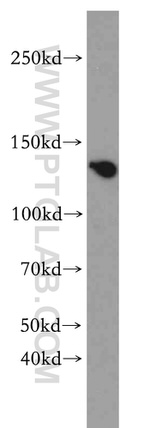 ZBTB40 Antibody in Western Blot (WB)