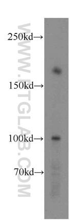 LAMC3 Antibody in Western Blot (WB)