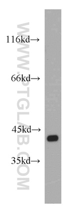 DAPK2 Antibody in Western Blot (WB)