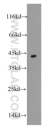 DAPK2 Antibody in Western Blot (WB)