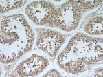 BAGE4 Antibody in Immunohistochemistry (Paraffin) (IHC (P))