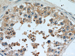 BAGE4 Antibody in Immunohistochemistry (Paraffin) (IHC (P))