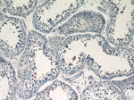 BAGE4 Antibody in Immunohistochemistry (Paraffin) (IHC (P))