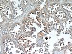 BAGE4 Antibody in Immunohistochemistry (Paraffin) (IHC (P))