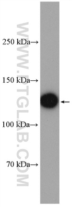 DGKK Antibody in Western Blot (WB)