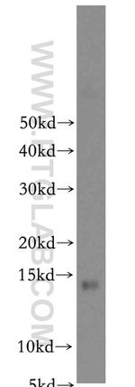 LDLRAD1 Antibody in Western Blot (WB)