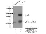 ACTR10 Antibody in Immunoprecipitation (IP)