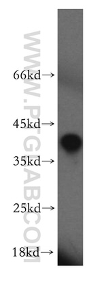 HAUS4 Antibody in Western Blot (WB)
