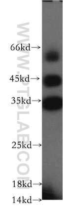 HAUS4 Antibody in Western Blot (WB)