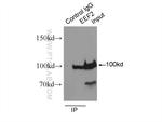 EEF2 Antibody in Immunoprecipitation (IP)