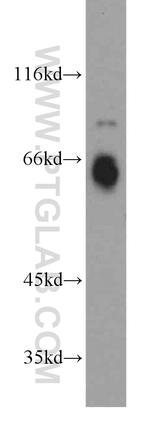 C18orf8 Antibody in Western Blot (WB)