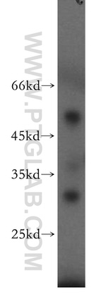 C14orf94 Antibody in Western Blot (WB)