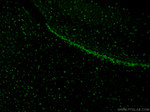 SOX2 Antibody in Immunohistochemistry (PFA fixed) (IHC (PFA))