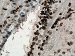 SOX2 Antibody in Immunohistochemistry (Paraffin) (IHC (P))