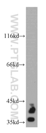 SOX2 Antibody in Western Blot (WB)