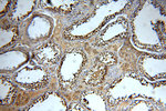 ZCCHC11 Antibody in Immunohistochemistry (Paraffin) (IHC (P))