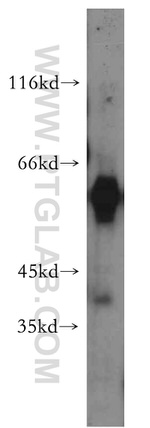 WDR13 Antibody in Western Blot (WB)