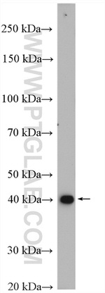 GTPBP5 Antibody in Western Blot (WB)