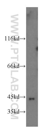 GTPBP5 Antibody in Western Blot (WB)