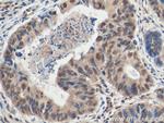 ZHX2 Antibody in Immunohistochemistry (Paraffin) (IHC (P))