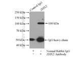 ZHX2 Antibody in Immunoprecipitation (IP)