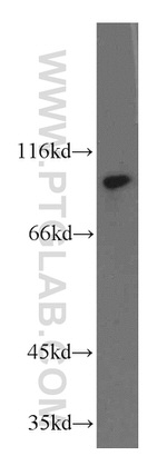 ZHX2 Antibody in Western Blot (WB)