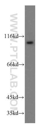 ZHX2 Antibody in Western Blot (WB)