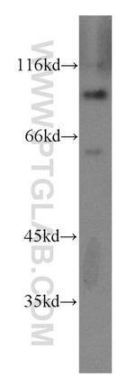 ZHX2 Antibody in Western Blot (WB)